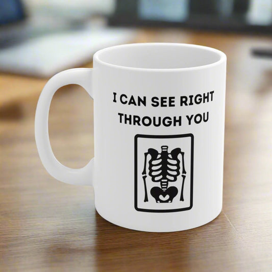 Radiology mug, X ray tech, Radiologist gift, Rads, IR, CT scan tech, MRI tech, Resident gift, doctor gift, medical assistant